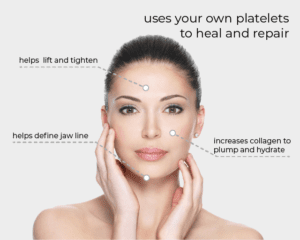 Life Mind Body by Karen Howell, Facial and Hair Aesthetics in Wokingham - use your own platelets to heal and repair