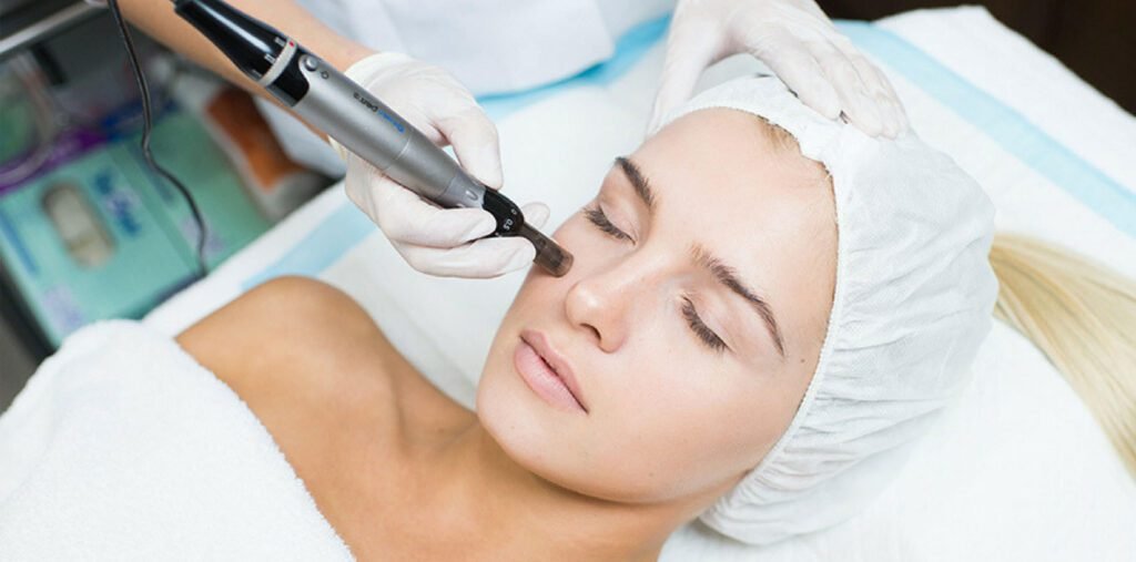 Life Mind Body by Karen Howell, Facial and Hair Aesthetics in Wokingham - Microneedling Treatment